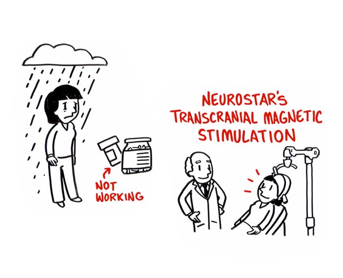 What is NeuroStar TMS Therapy