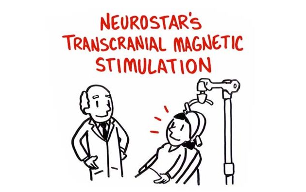 Cartoon drawing of NeuroStars Transcranial Magnetic Stimulation treatment